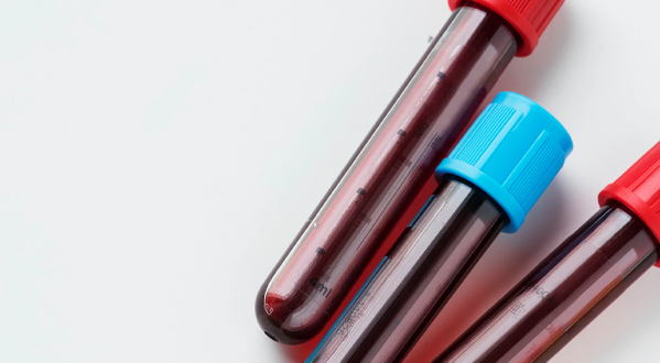 analisis de parametros sanguineos farmacia mariano lucas tomas en yecla ortopedia farmacia mariano lucas tomas yecla